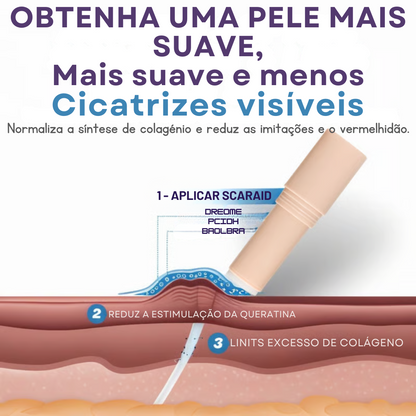 Barra de silicone para hidratar a pele e tratar cicatrizes (OFERTA 2 POR 1)